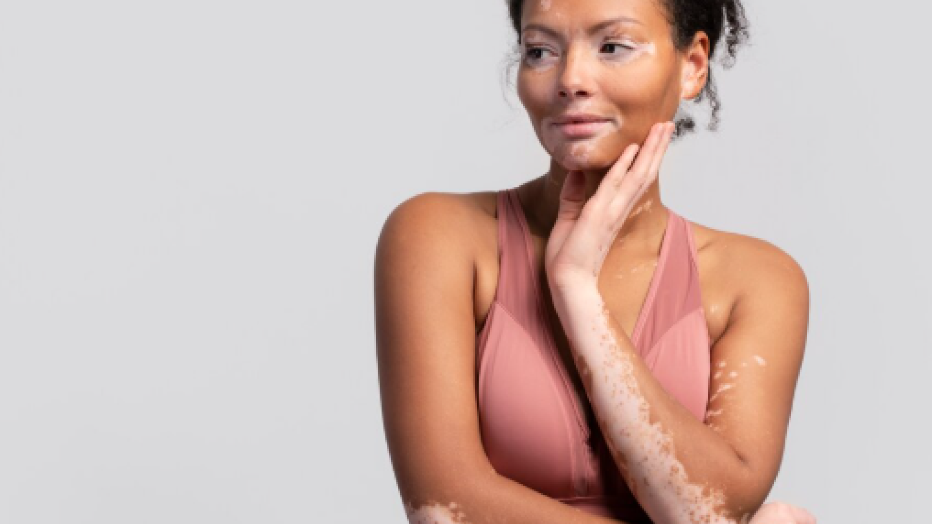 Manchas na pele: quando procurar um dermatologista?