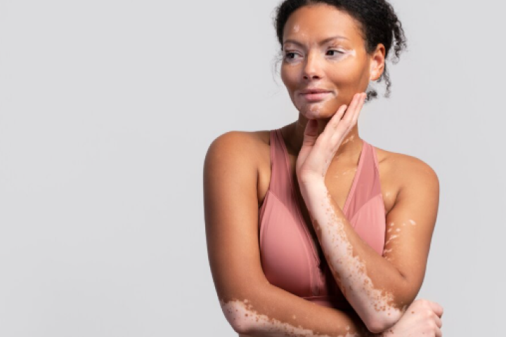 Manchas na pele: quando procurar um dermatologista?